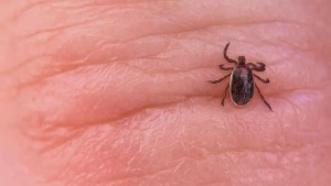 Tick Bite Paralyzes Fitness Influencer: A Wake-Up Call for Outdoor Enthusiasts